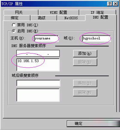 DNS错误 DNS错误